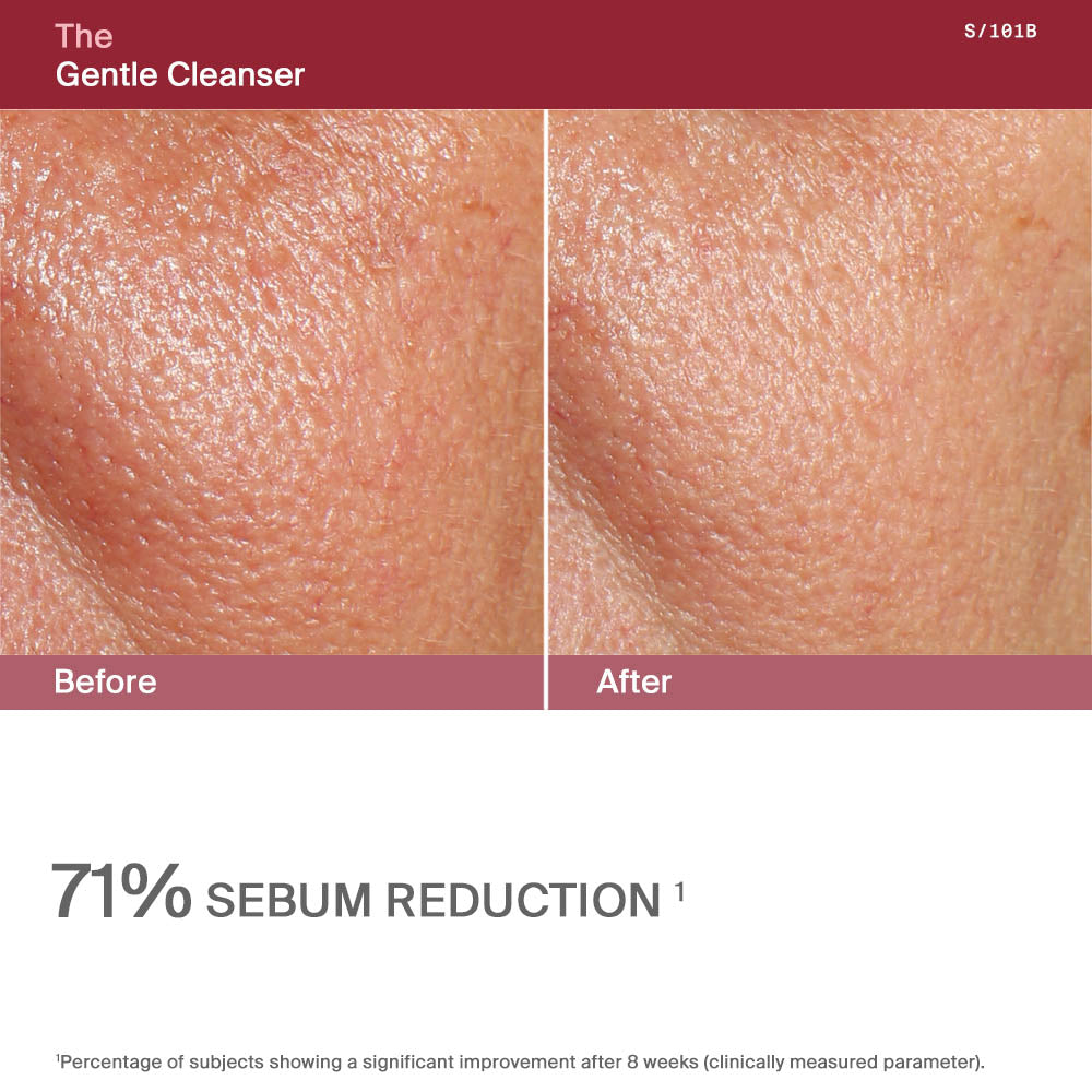 The Gentle Cleanser