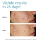 Purifying Anti-Blemish Cleansing Gel