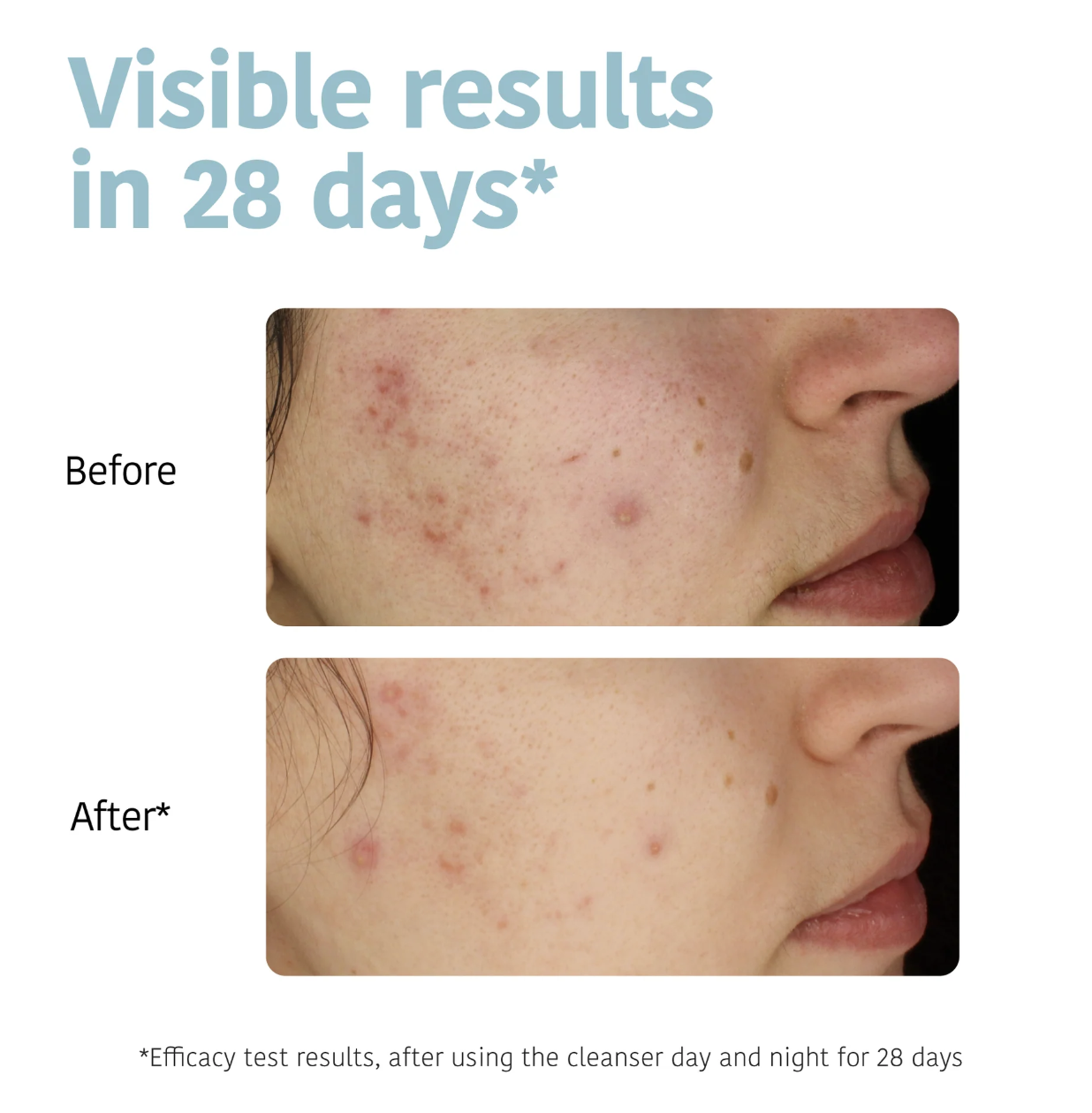 Purifying Anti-Blemish Cleansing Gel
