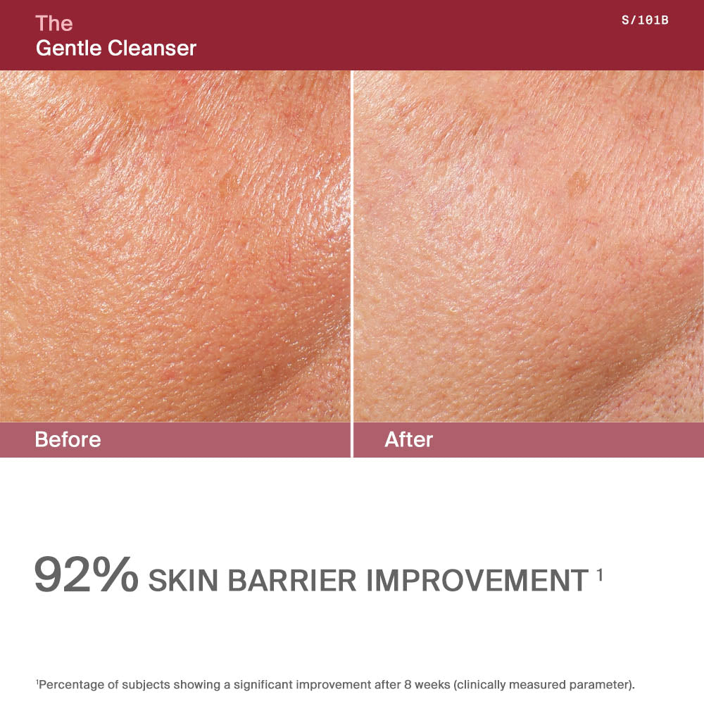 The Gentle Cleanser