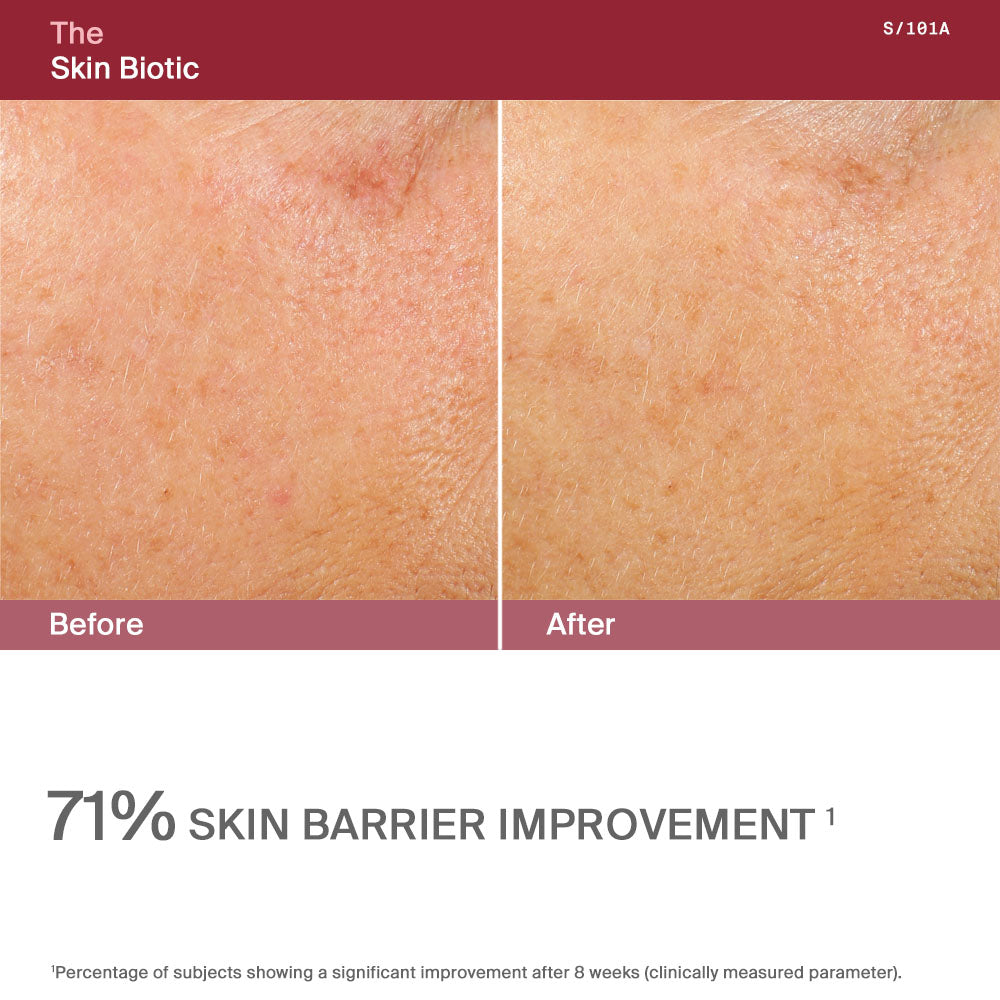 The Skin Biotic