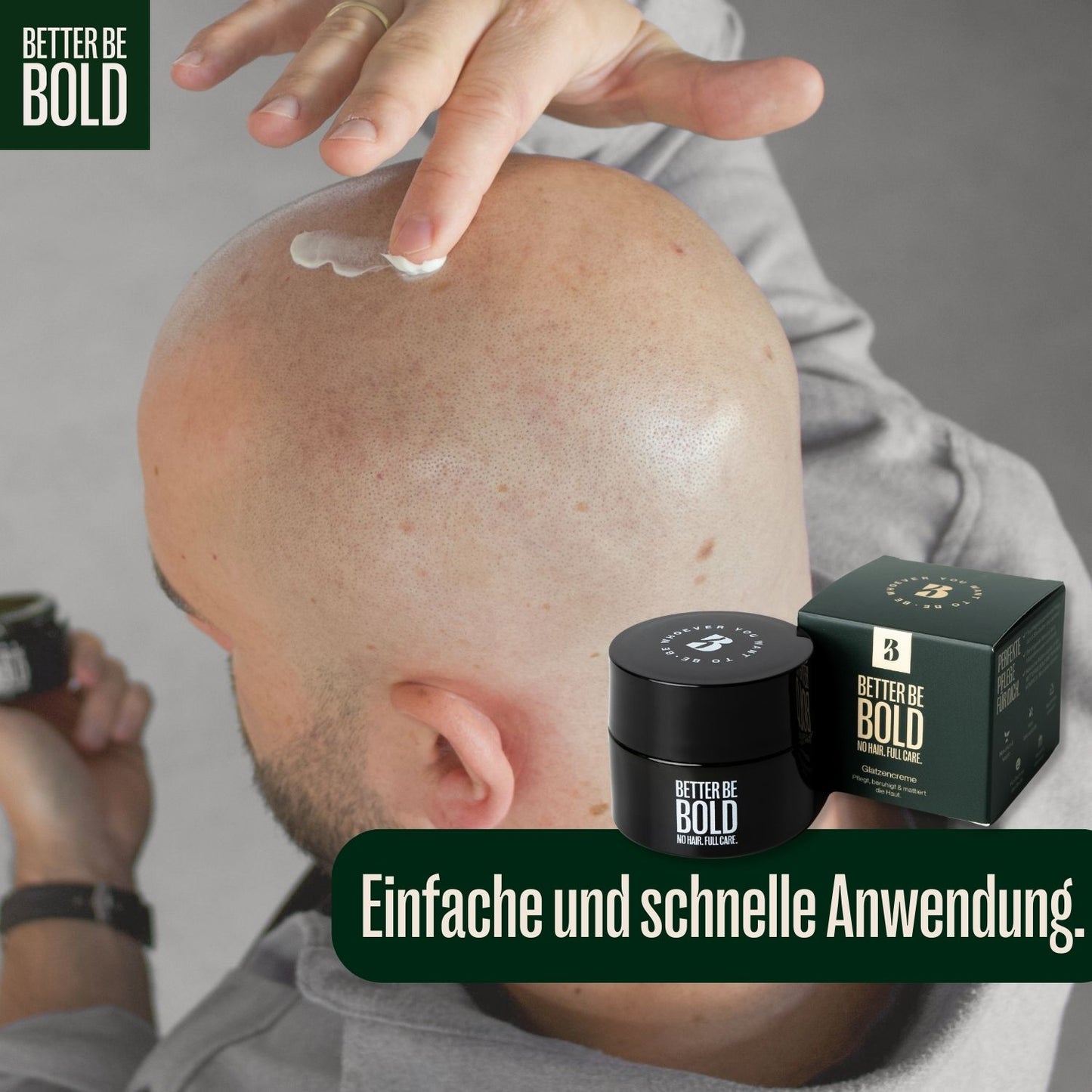 Crème calvitie