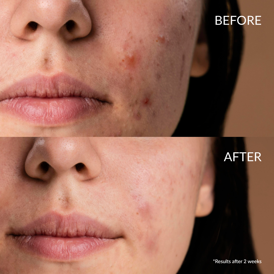 Serum Clearer Days