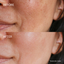 Serum quench up